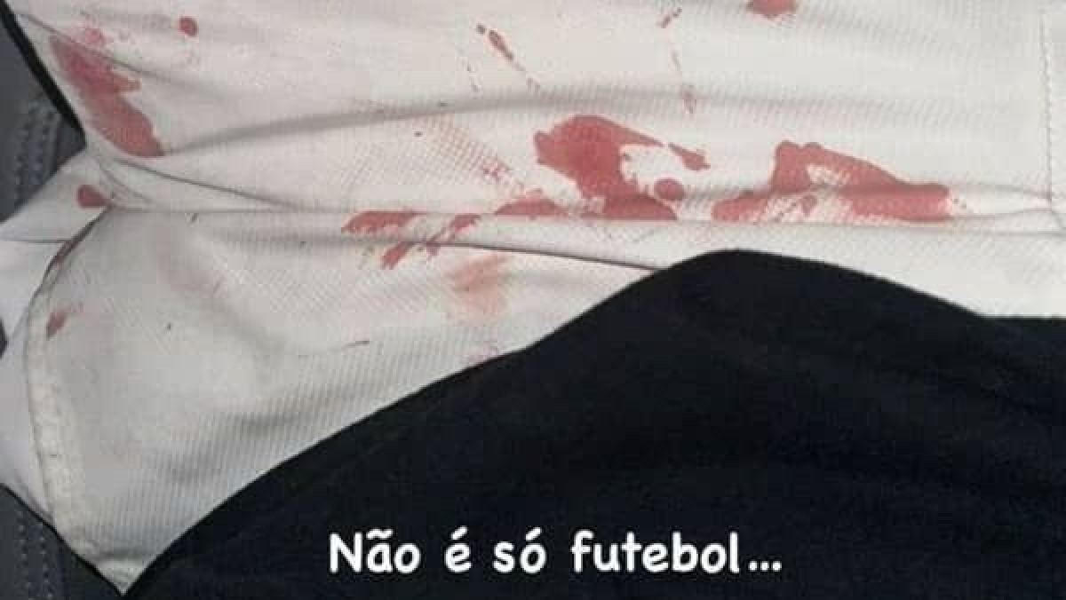 Luan, do Corinthians, publica foto com sangue após agressões: “Não é só futebol”